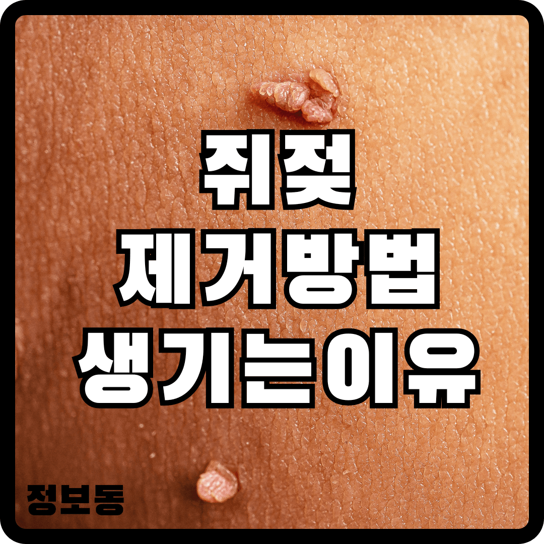 쥐젖 제거방법 생기는 이유