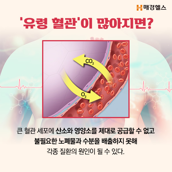 고지혈증 초기증상&amp;#44; 특별한 통증이 없는데 위험한 이유