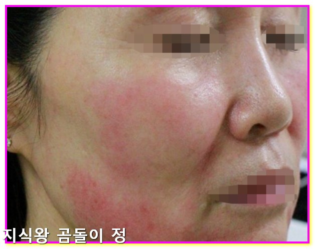 갱년기 관절통 수면장애 줄이는 하루 5단계 루틴 공개5