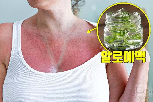 피부 탔을때 하얗게 얼굴 탄거 복구 알로에팩