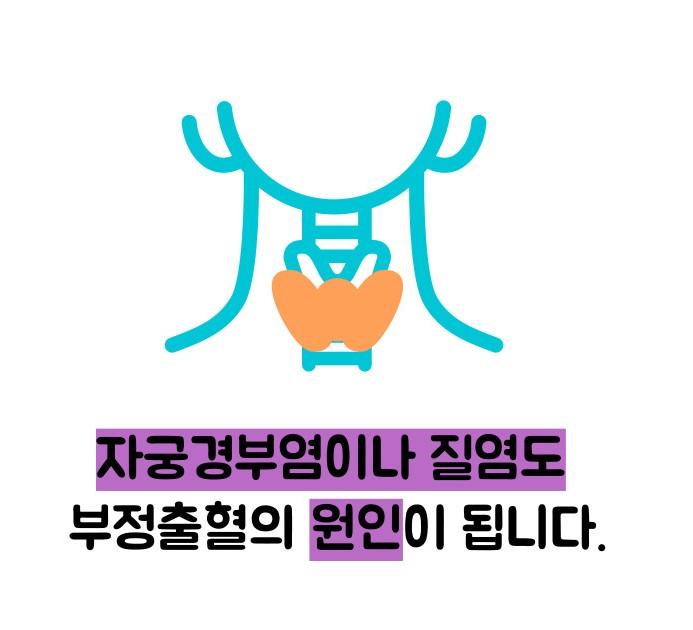 부정출혈 원인