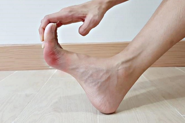 발바닥 뒤꿈치 통증 찌릿찌릿, 아플때 하는 운동 스트레칭 , 팁줌