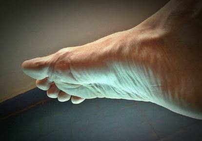 발바닥 가운데 통증