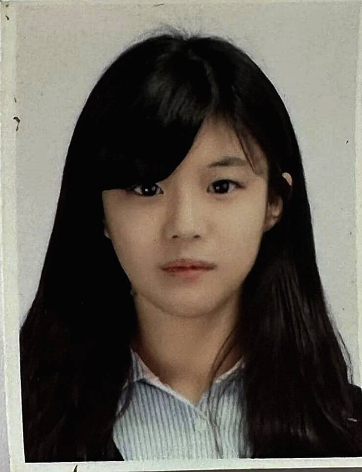 고윤정 성형 의혹
