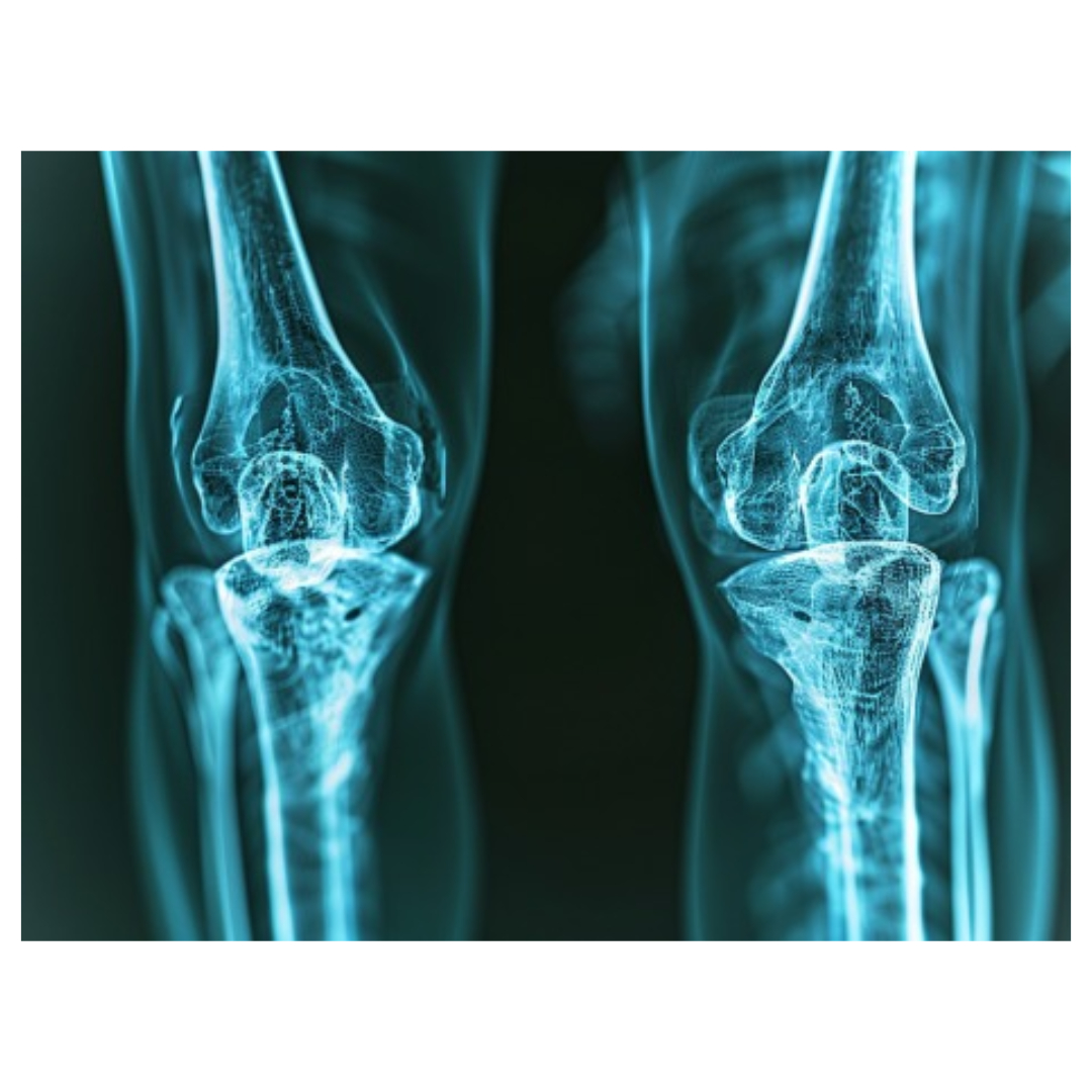 류마티스 관절염과 관련된 사진입니다.