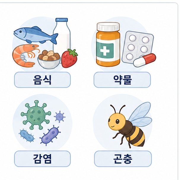 음식과 약물, 감염, 곤충 등 두드러기를 유발할 수 있는 대표적인 요인을 보여주는 그림