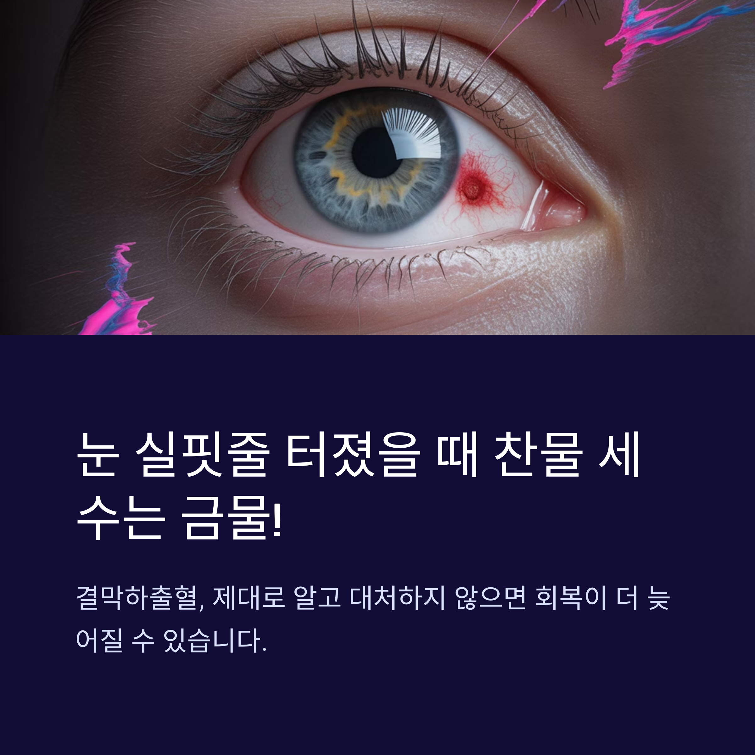 눈 실핏줄