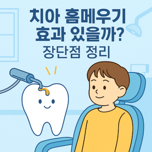 유아 치아 홈메우기(치아 실란트)의 장점 단점