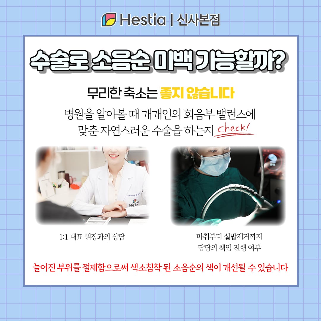 수술로 소음순 색깔 개선 가능할까?