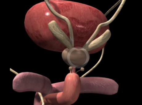 전립선 비대증 약물