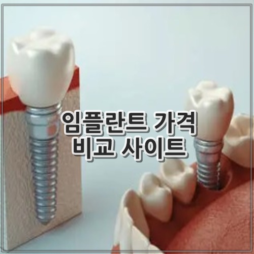 임플란트 가격비교 사이트
