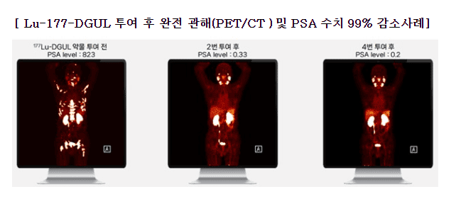 셀비온 감소사례