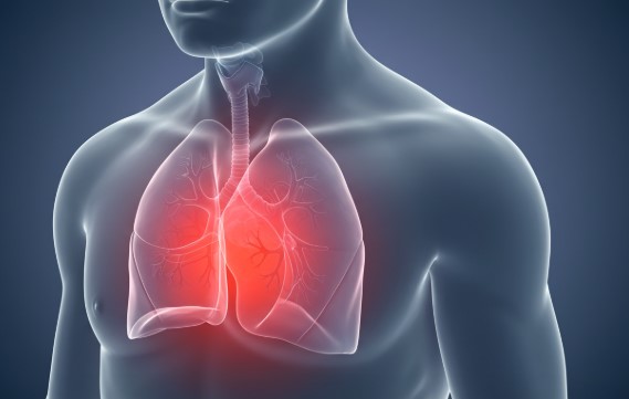 심장마비 전조증상 (가슴 통증, 숨 가쁨, 피로감 등)