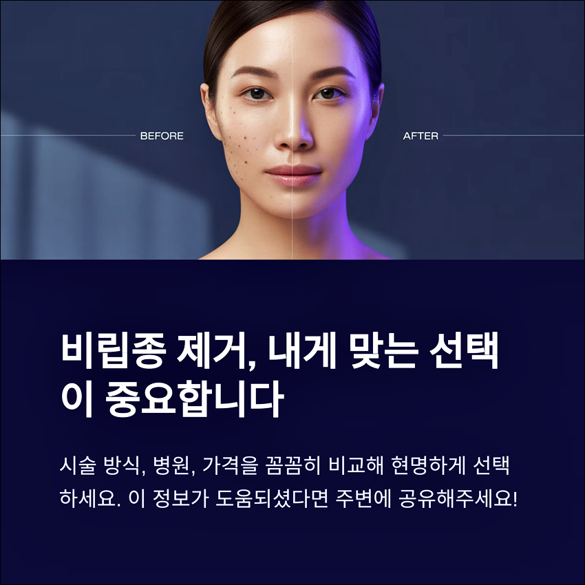 비립종 제거 비용 후기