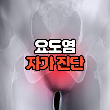 요도염 자가진단