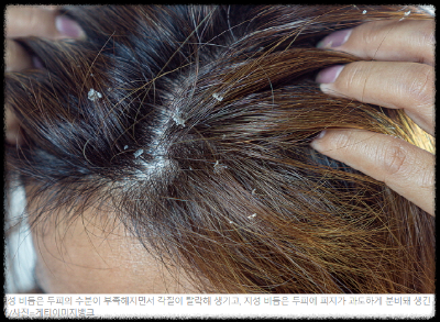 비둠-비듬-비듬