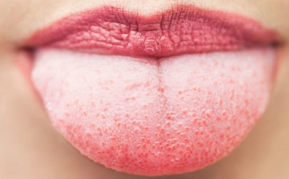 혀-바닥-내민-모습-붉은입술