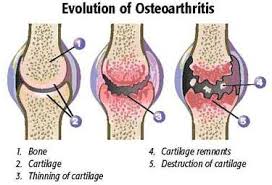 콘드로이친 효능