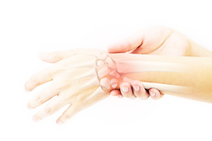 류머티스관절염-이미지