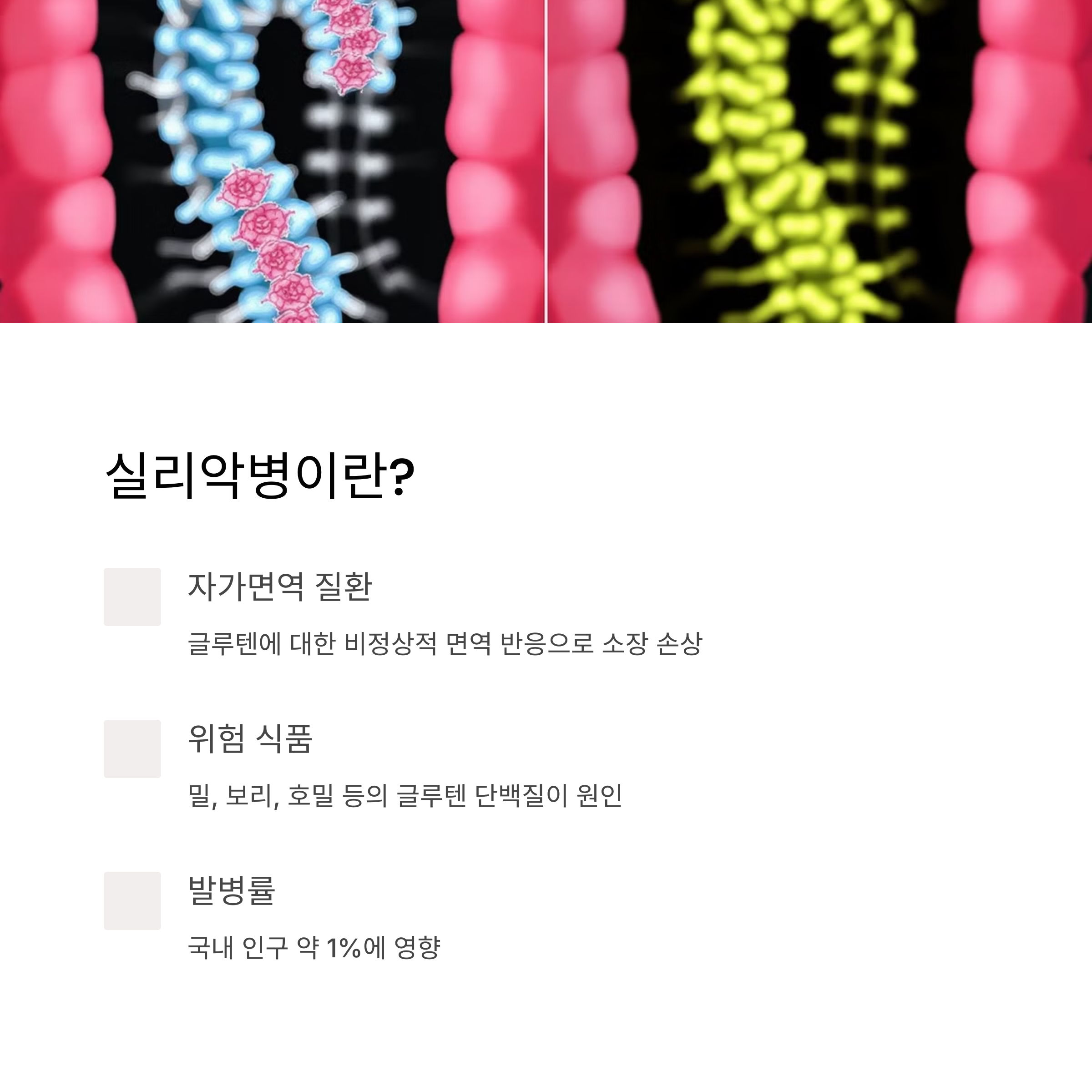 실리악병의 정의와 원인