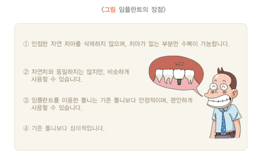임플란트의 장점