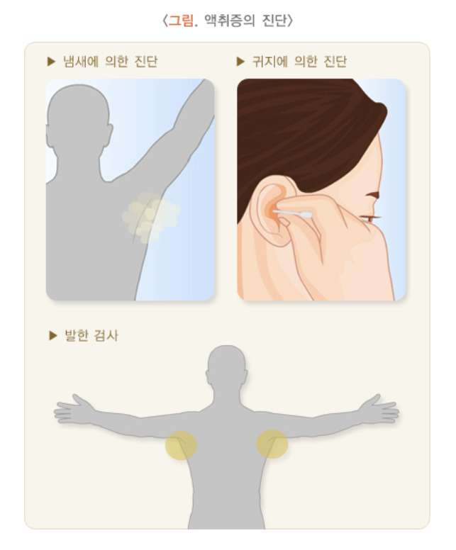 액취증의 진단