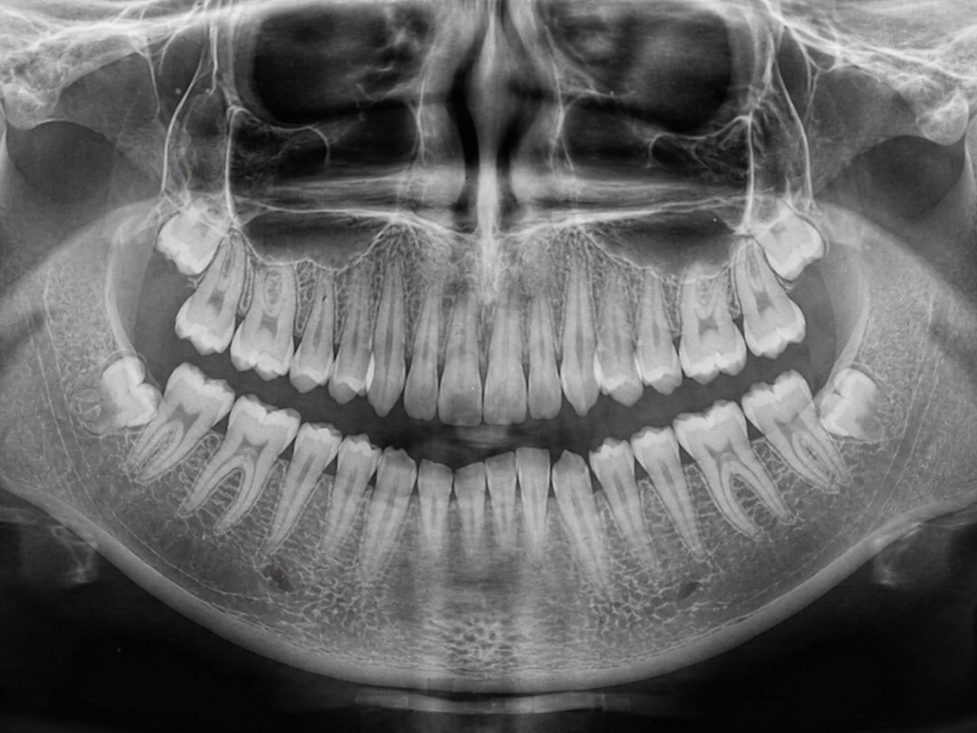 Temporomandibular