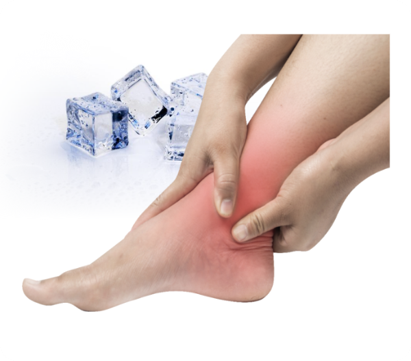 초기 응급처치: 냉찜질