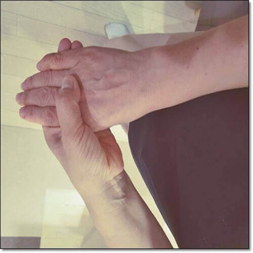 손가락 관절 염 환자