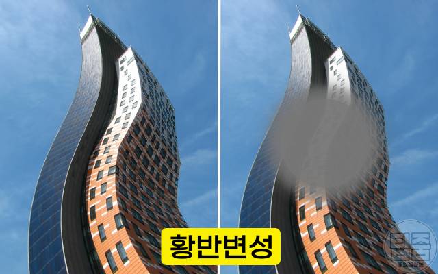 실명 전조증상 황반변성