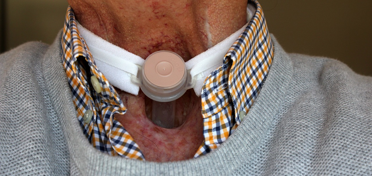 기관 절개관을 가지고 있는 사람의 모습