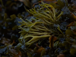 갑상선 기능 저하증에 좋은 음식 영양제 식단