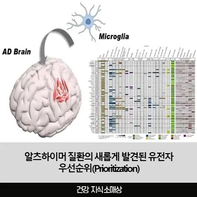 알츠하이머와 관련된 새로운 42개 유전자 발견