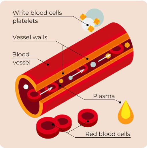 혈관에 끼어 있는 찌꺼기들