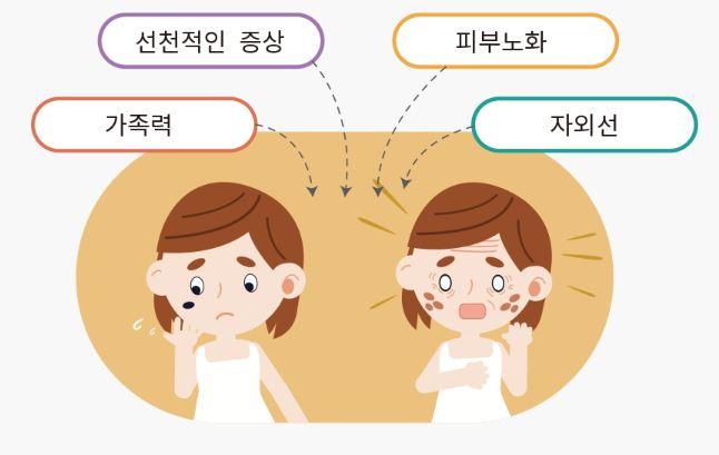 검버섯 제거크림 추천