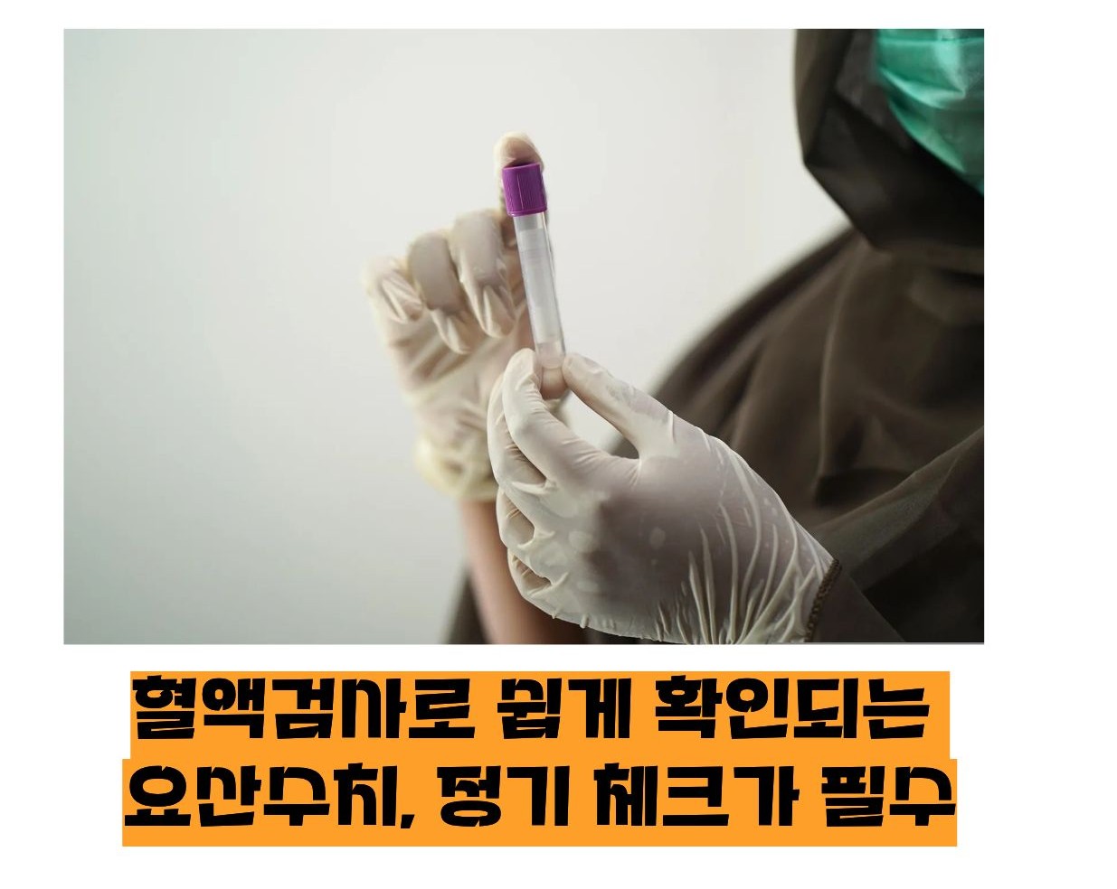 요산수치 정상범위