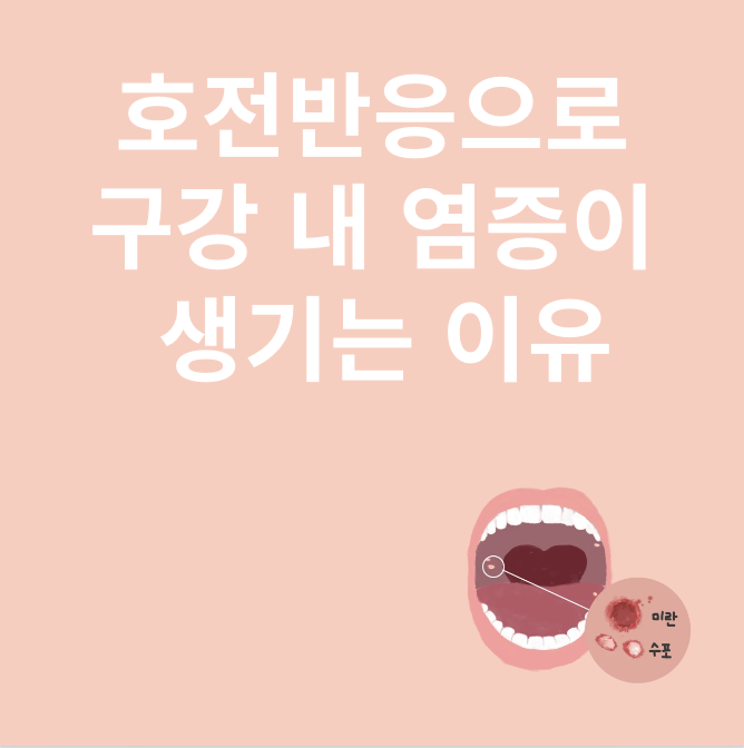 구강내 염증과 관련된 이미지