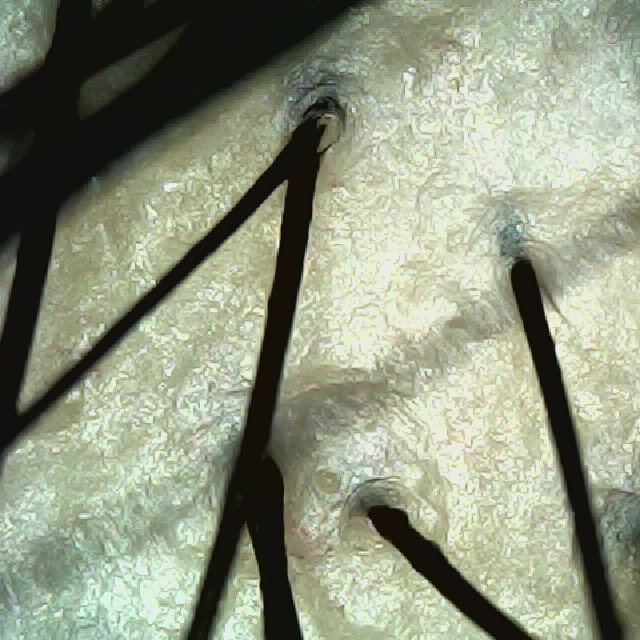 정수리 두피 모습이다.