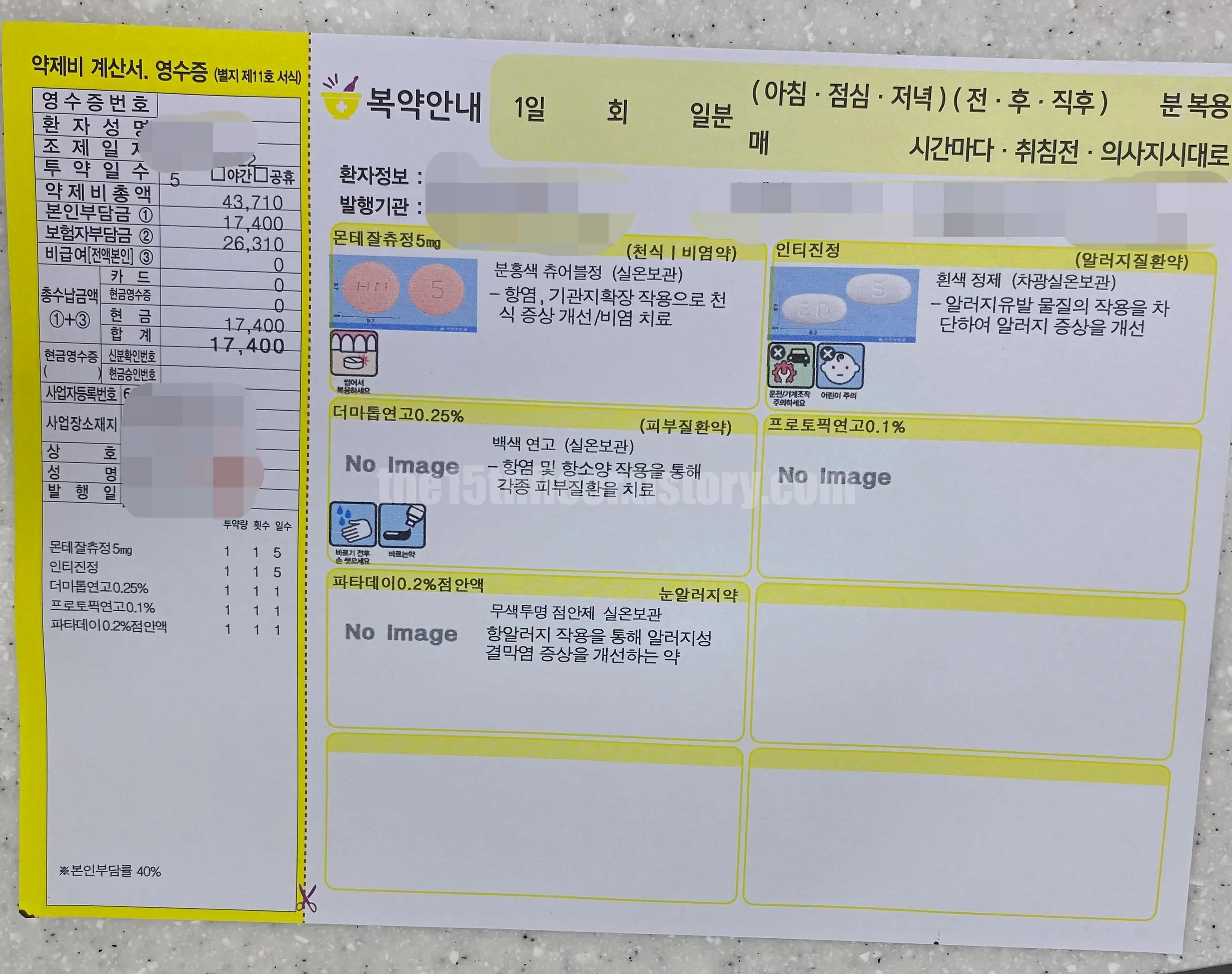 처방 약 복용 후기 (먹는 약 + 연고)