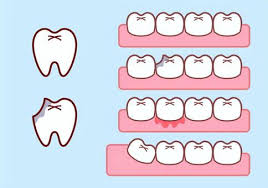 잇몸 염증 베스트