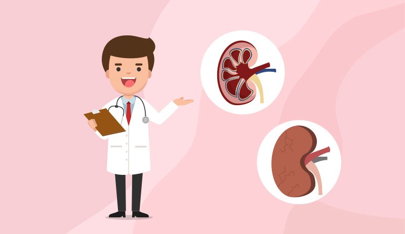 급성 신부전 증상. 치료