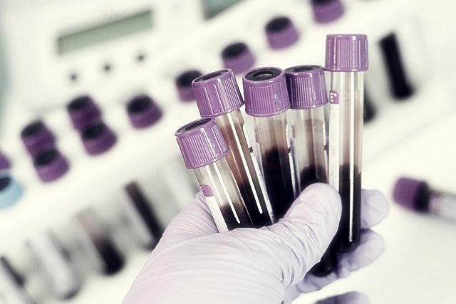 네이처셀 주가분석