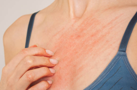 가려워 긁고있는 사진