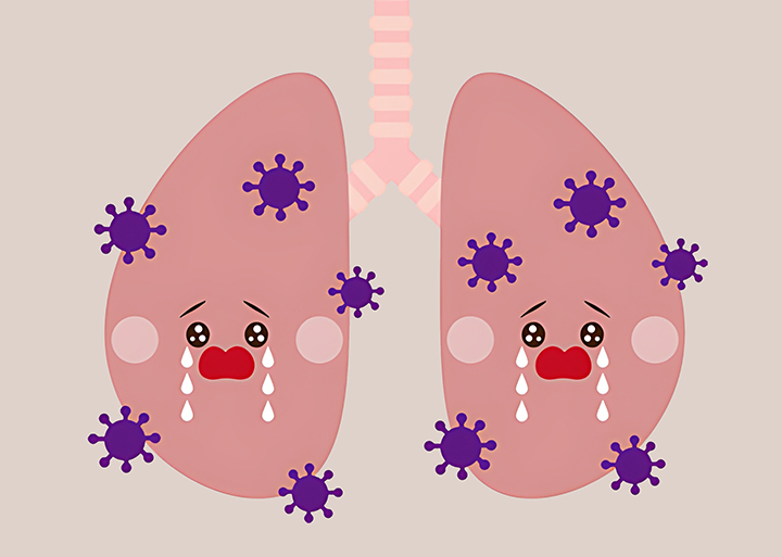 흡입으로-인한-폐렴