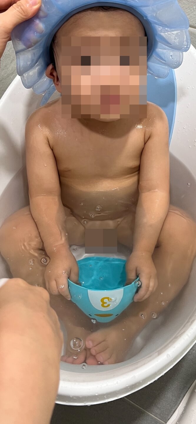 영유아 아토피 치료후기(ft.제로이드) - 9개월뒤(좌측)&amp;#44; 12개월뒤(가운데)&amp;#44; 13개월뒤(우측)