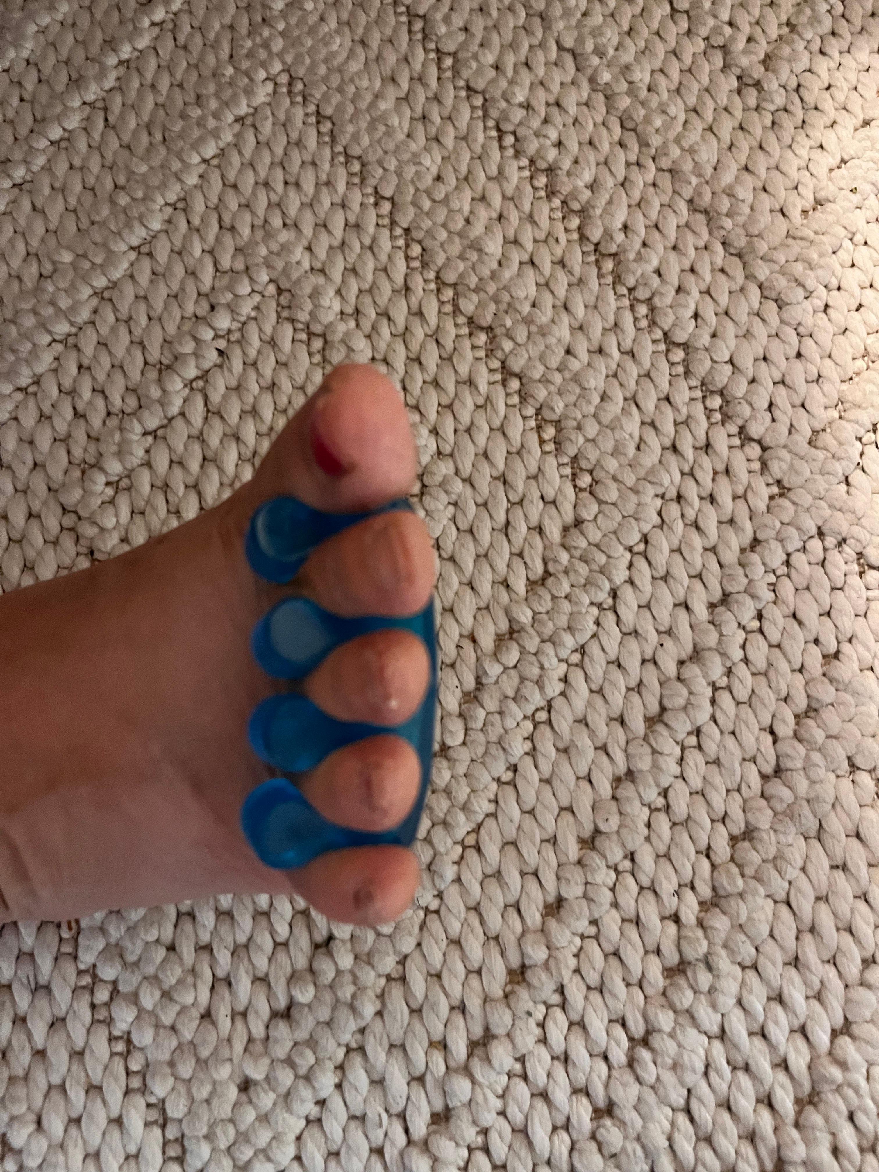 발가락 분리기를 발가락 사이에 끼우고 있는 이미지