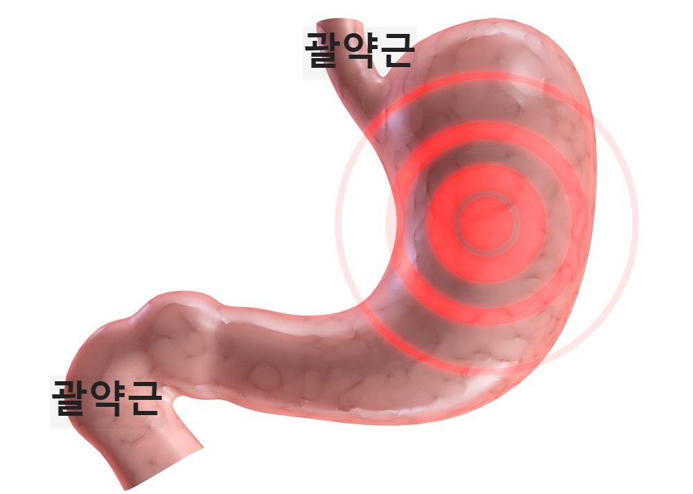 급체-증상