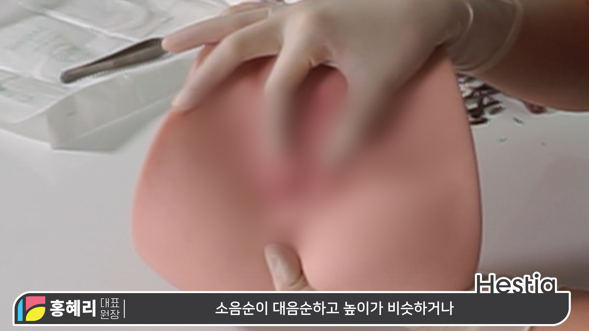 소음순성형수술 과정 대.공.개 ※수술 시물레이션 포함!
