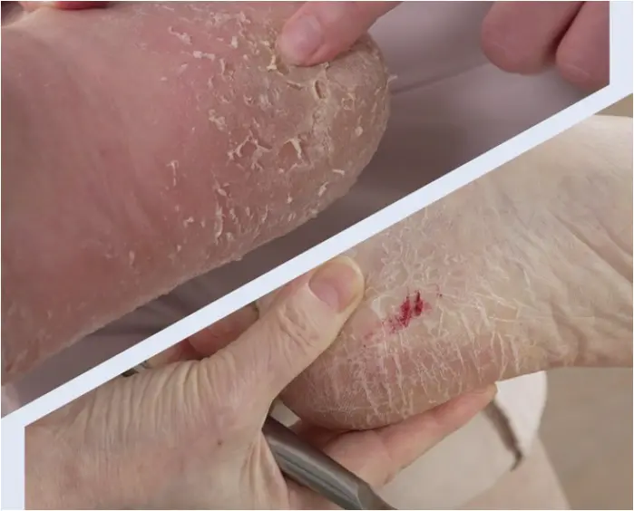 풋조아 FOOTJOA 전동 발 각질 제거기