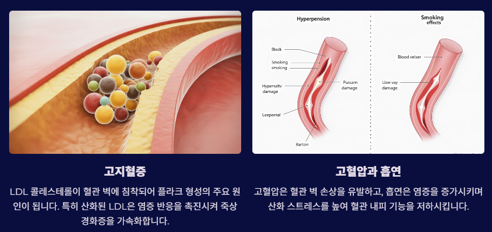 죽상경화증의 원인